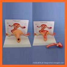 Ovário de útero humano Modelo anatômico de seção transversal de anatomia
